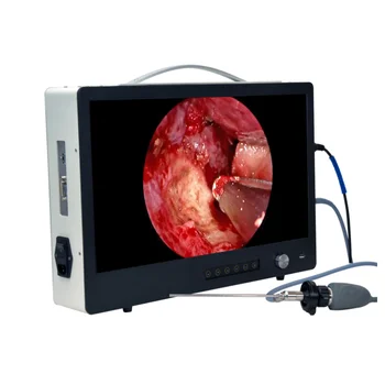 Цена по прейскуранту завода-изготовителя 4 в 1 система камеры для медицинского эндоскопа Full HD с 24-дюймовым монитором, светодиодным источником света мощностью 100 Вт и HD-рекордером